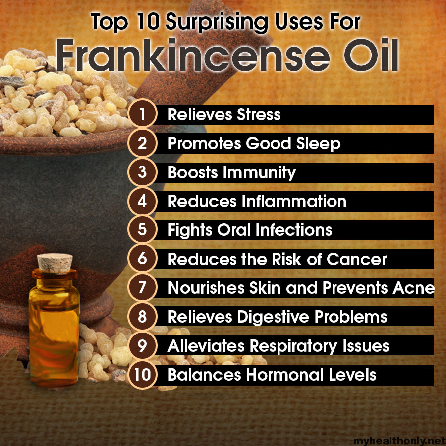 Frankincense Roll-On Essential Oil--for Anxiety and stress, Aromatherapy